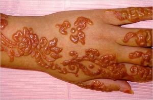 Typical "Black henna" reaction: swelling, itching, blistering, scarring and more.